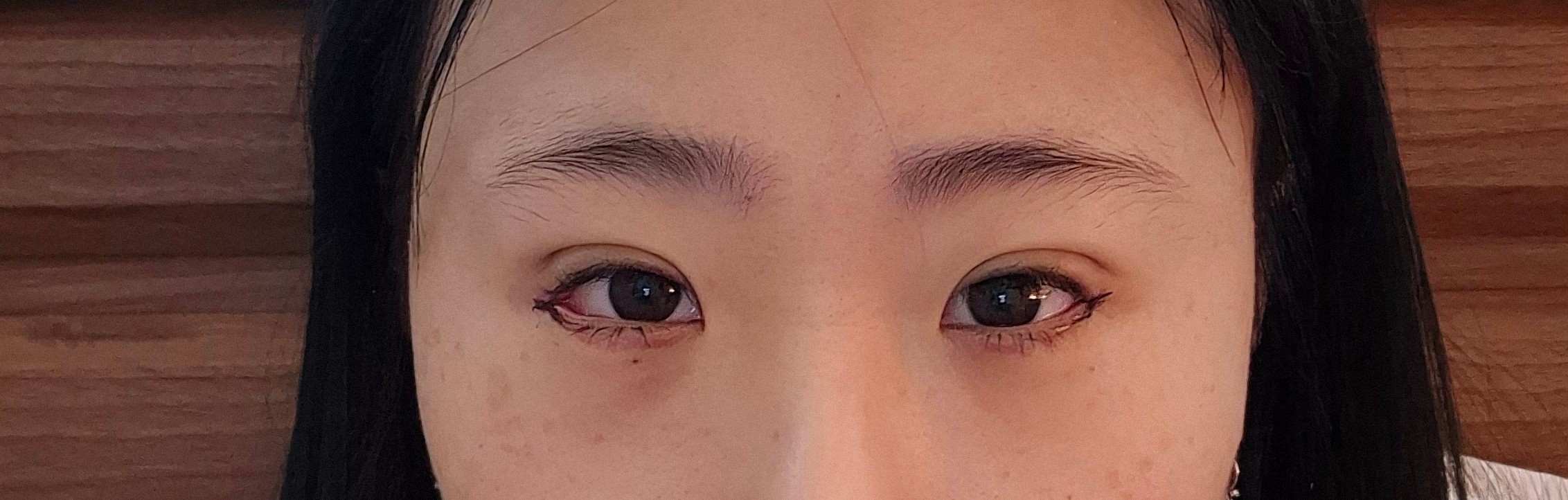 소세지 붓기 빠질까..?